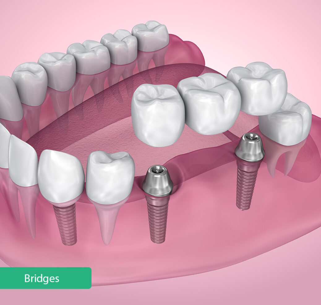 Treatment -  Belmont House Dental